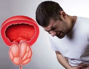 A tünetek krónikus prosztata a férfiak